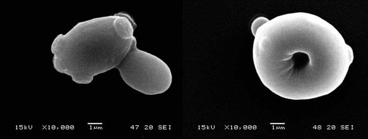 Elektronenmikroskopische Aufnahmen der untergärigen Hefe TUM 34/70: links Reinzuchthefe, rechts Erntehefe nach der fünften Führung