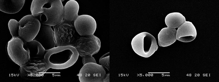  Elektronenmikroskopische Aufnahmen der untergärigen Hefe TUM 34/70: links unter osmotischem Druck, rechts unter Nährstoffmangel
