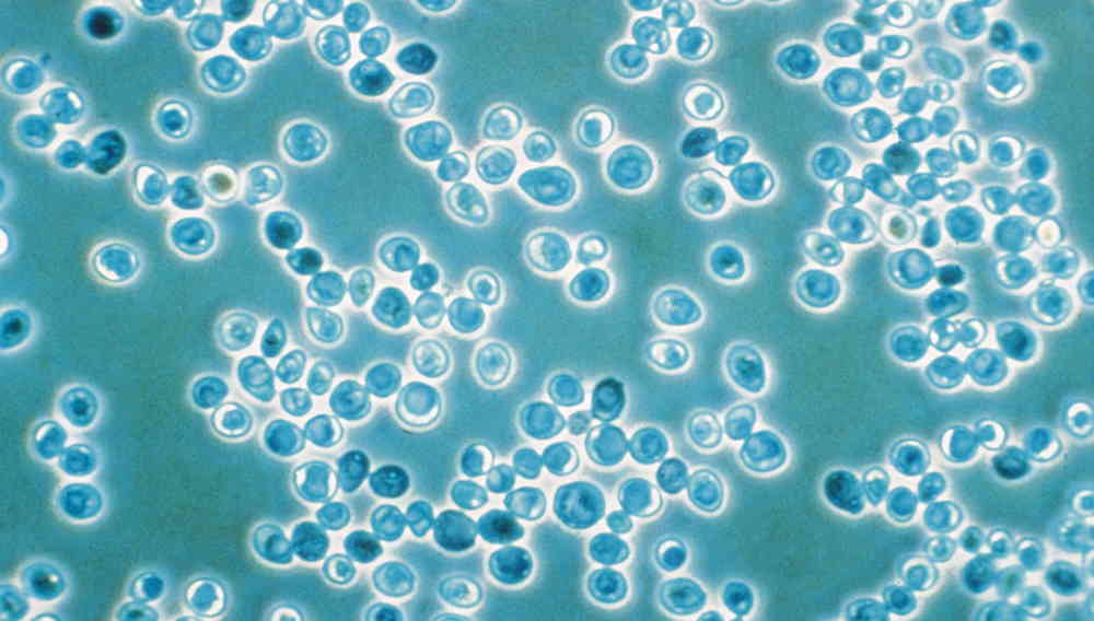 Hefezellen: die von ihnen gebildeten Aromastoffe sind für 70 Prozent des Bieraromas verantwortlich